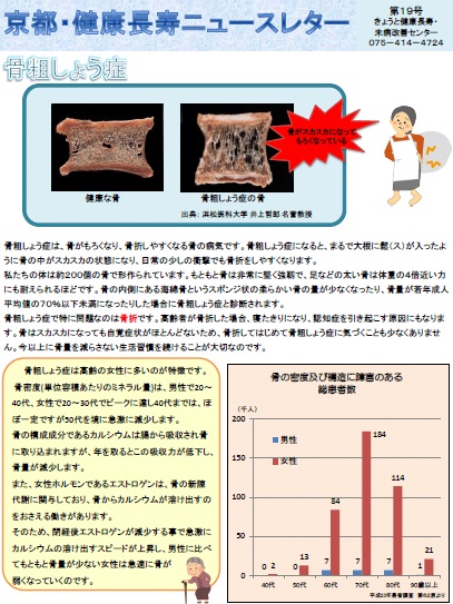 ニュースレター（骨粗しょう症）