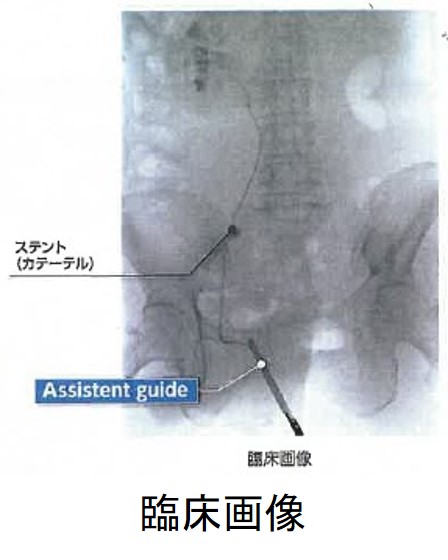 臨床画像